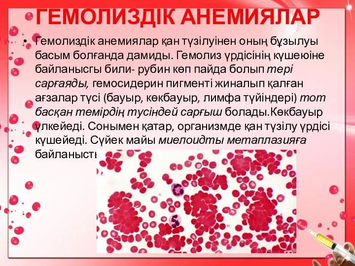 ГЕМОЛИЗДІК АНЕМИЯЛАР Гемолиздік анемиялар қан түзілуінен оның бұзылуы басым болғанда дамиды. Гемолиз үрдісінің