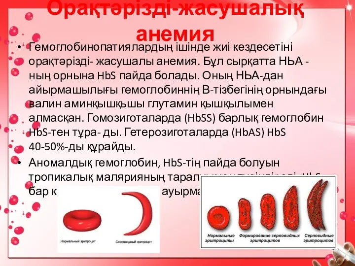 Орақтәрізді-жасушалық анемия Гемоглобинопатиялардың ішінде жиі кездесетіні орақтәрізді- жасушалы анемия. Бұл