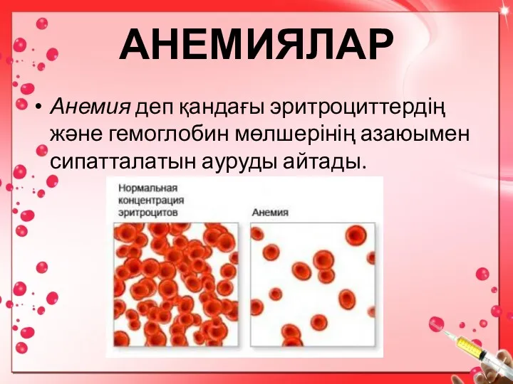 АНЕМИЯЛАР Анемия деп қандағы эритроциттердің және гемоглобин мөлшерінің азаюымен сипатталатын ауруды айтады.