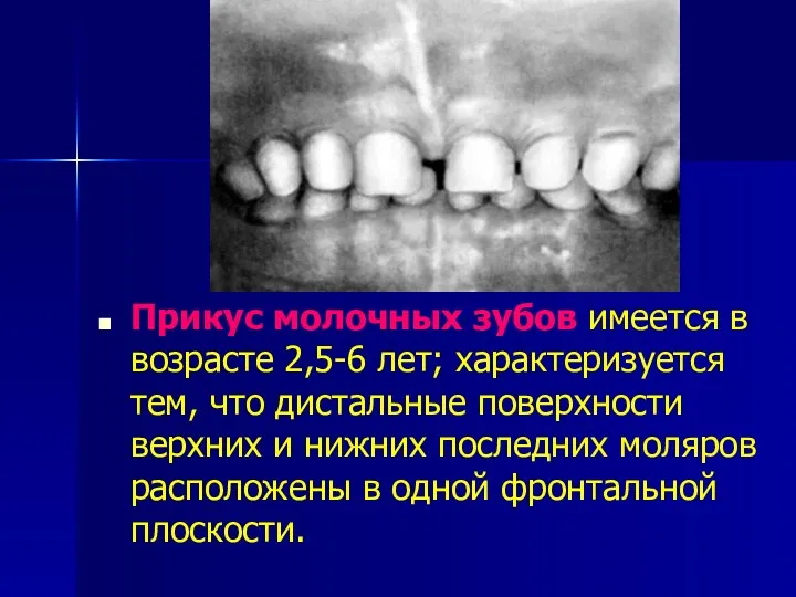 Прикус молочных зубов имеется в возрасте 2,5-6 лет; характеризуется тем,