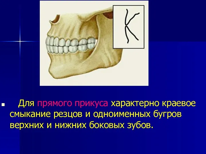 Для прямого прикуса характерно краевое смыкание резцов и одноименных бугров верхних и нижних боковых зубов.