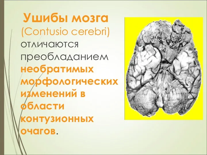 Ушибы мозга (Contusio cerebri) отличаются преобладанием необратимых морфологических изменений в области контузионных очагов.