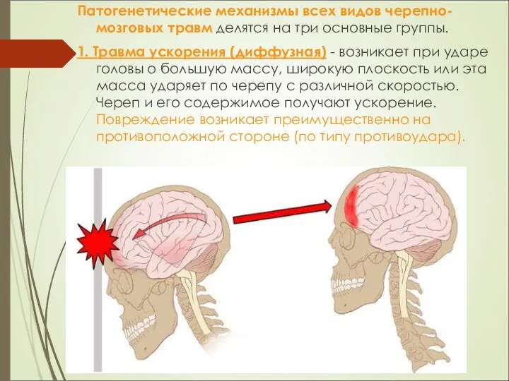 Патогенетические механизмы всех видов черепно-мозговых травм делятся на три основные группы. 1. Травма