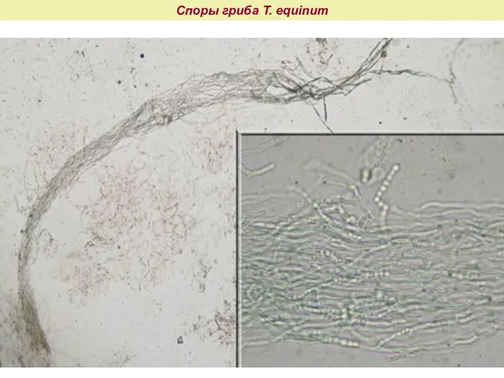 Споры гриба T. equinum