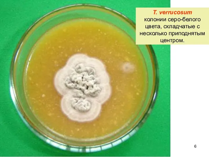T. verrucosum колонии серо-белого цвета, складчатые с несколько приподнятым центром.