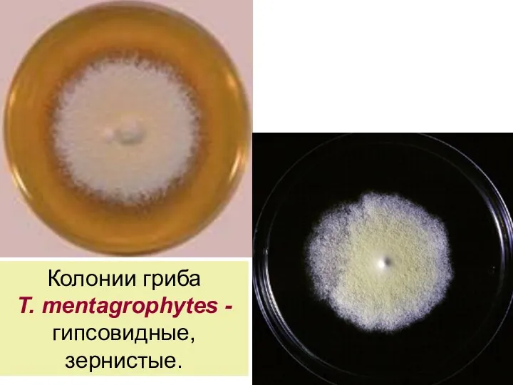 Колонии гриба T. mentagrophytes -гипсовидные, зернистые.