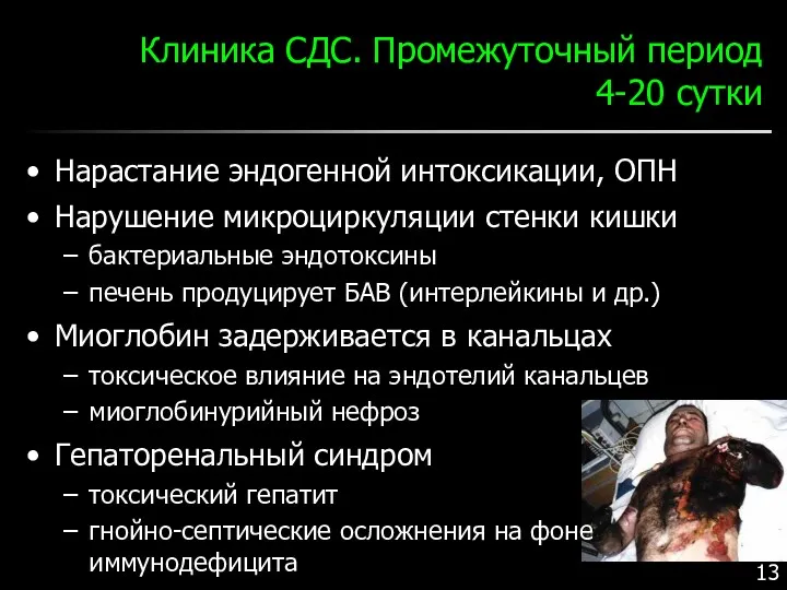 Клиника СДС. Промежуточный период 4-20 сутки Нарастание эндогенной интоксикации, ОПН