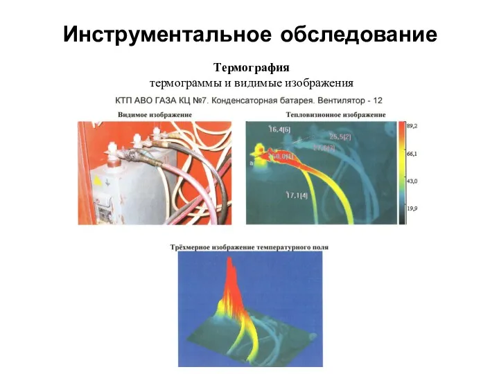 Инструментальное обследование Термография термограммы и видимые изображения