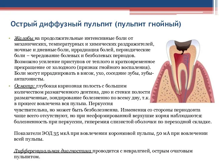 Острый диффузный пульпит (пульпит гнойный) Осмотр: глубокая кариозная полость с