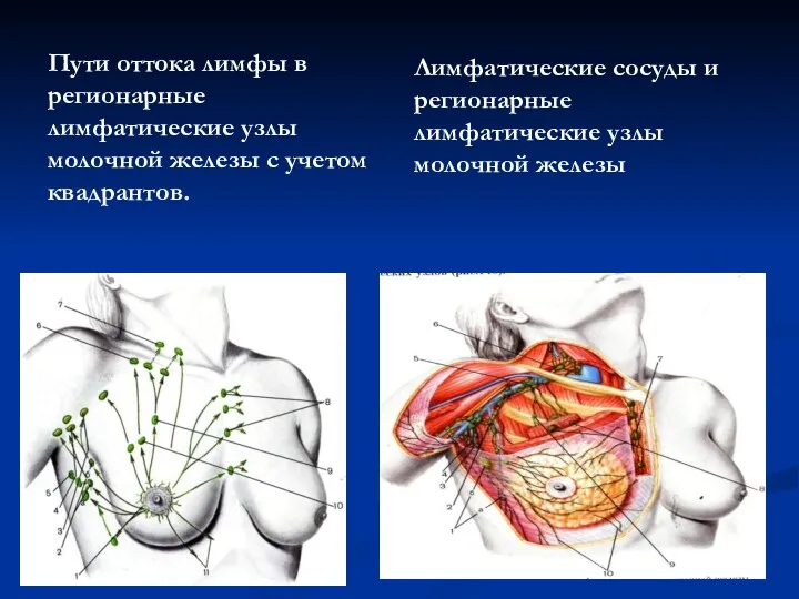 Пути оттока лимфы в регионарные лимфатические узлы молочной железы с учетом квадрантов. Лимфатические