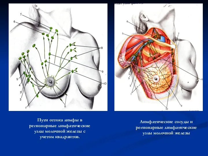 Пути оттока лимфы в регионарные лимфатические узлы молочной железы с учетом квадрантов. Лимфатические