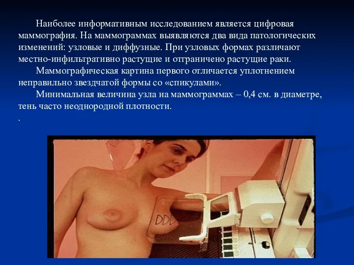 Наиболее информативным исследованием является цифровая маммография. На маммограммах выявляются два вида патологических изменений: