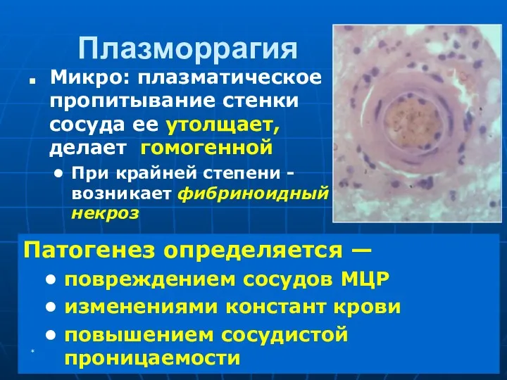 Плазморрагия Микро: плазматическое пропитывание стенки сосуда ее утолщает, делает гомогенной