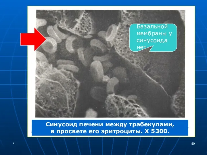 Синусоид печени между трабекулами, в просвете его эритроциты. Х 5300. Базальной мембраны у синусоида нет *