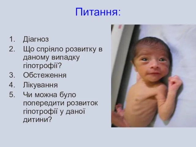 Питання: Діагноз Що спріяло розвитку в даному випадку гіпотрофії? Обстеження