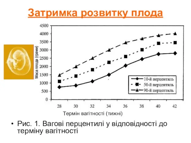 Затримка розвитку плода Рис. 1. Вагові перцентилі у відповідності до терміну вагітності Термін вагітності (тижні)