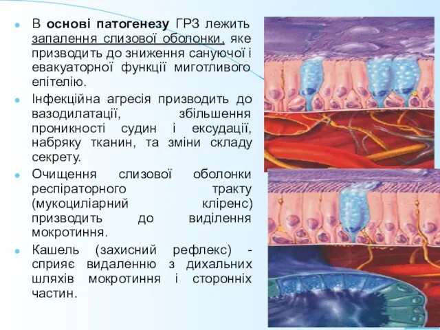 В основі патогенезу ГРЗ лежить запалення слизової оболонки, яке призводить