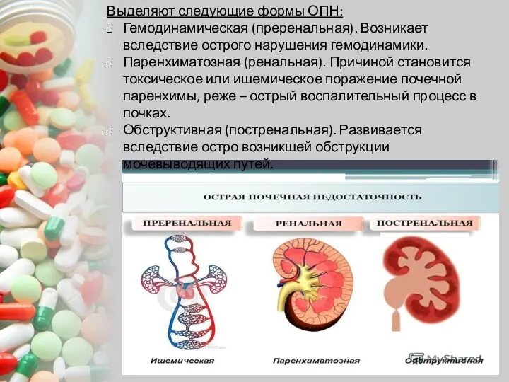 Выделяют следующие формы ОПН: Гемодинамическая (преренальная). Возникает вследствие острого нарушения