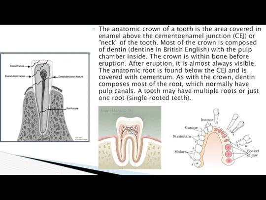 The anatomic crown of a tooth is the area covered