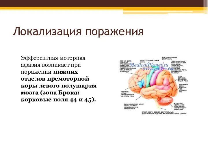 Локализация поражения Эфферентная моторная афазия возникает при поражении нижних отделов