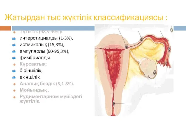 Жатырдан тыс жүктілік классификациясы : Түтіктік (98,5-99%): интерстициалды (1-3%), истмикалық