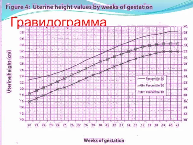 Гравидограмма