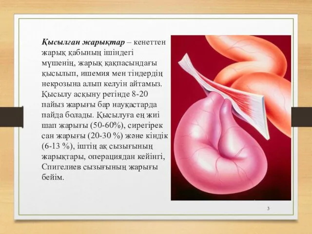 Қысылған жарықтар – кенеттен жарық қабының ішіндегі мүшенің, жарық қақпасындағы