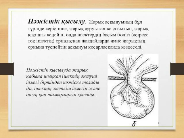 Нәжістік қысылу. Жарық асқынуының бұл түрінде керісінше, жарық ауруы көпке