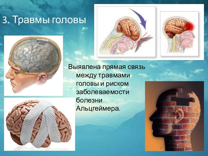 3. Травмы головы Выявлена прямая связь между травмами головы и риском заболеваемости болезни Альцгеймера.