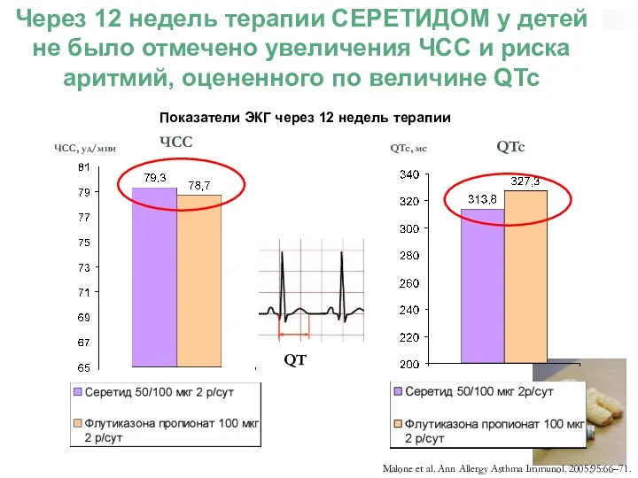 Показатели ЭКГ через 12 недель терапии Malone et al. Ann