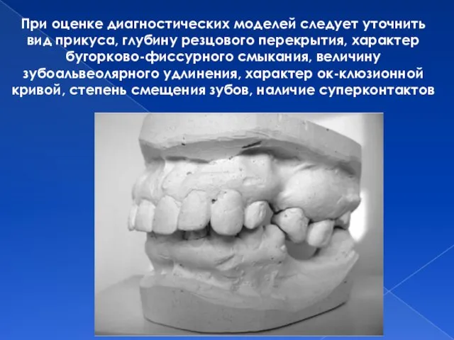 При оценке диагностических моделей следует уточнить вид прикуса, глубину резцового