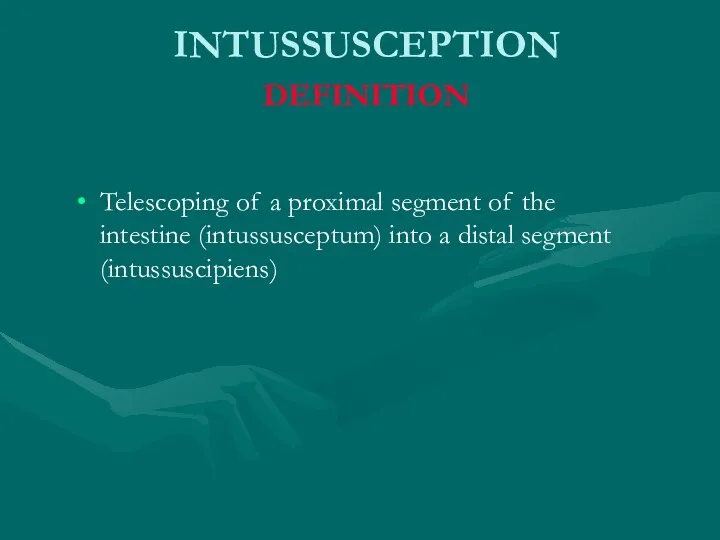 INTUSSUSCEPTION DEFINITION Telescoping of a proximal segment of the intestine (intussusceptum) into a distal segment (intussuscipiens)