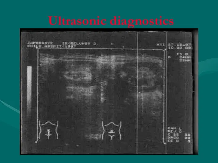 Ultrasonic diagnostics
