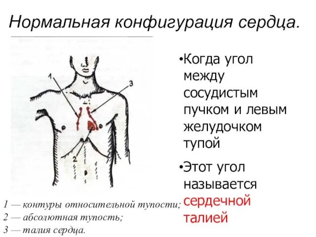 Нормальная конфигурация сердца. 1 — контуры относительной тупости; 2 —