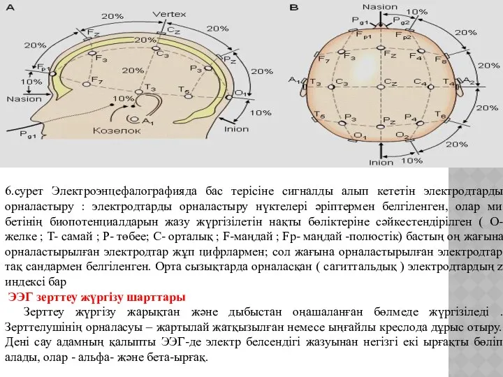 6.сурет Электроэнцефалографияда бас терісіне сигналды алып кететін электродтарды орналастыру :