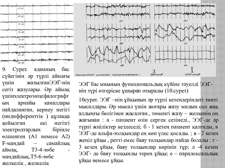 9. Сурет. адамның бас сүйегінің әр түрлі аймағы үшін жазылғанЭЭГ-нің