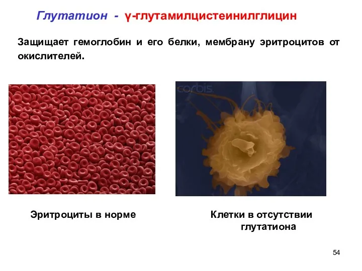 Эритроциты в норме Клетки в отсутствии глутатиона Защищает гемоглобин и