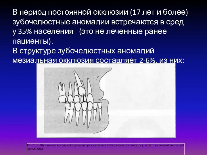 В период постоянной окклюзии (17 лет и более) зубочелюстные аномалии встречаются в сред