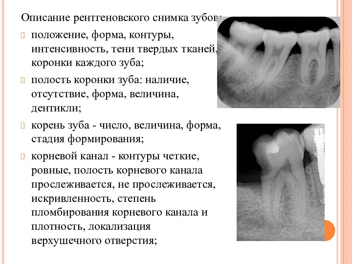 Описание рентгеновского снимка зубов: положение, форма, контуры, интенсивность, тени твердых