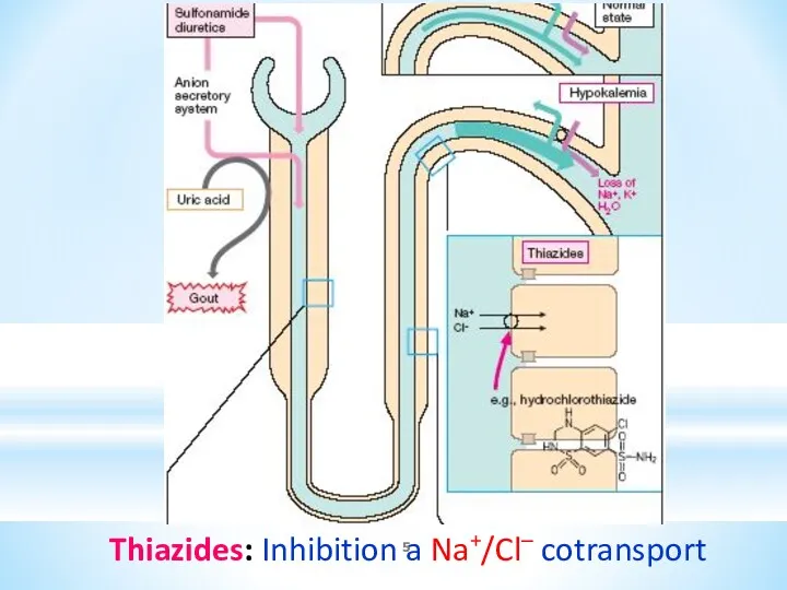 Thiazides: Inhibition a Na+/Cl– cotransport