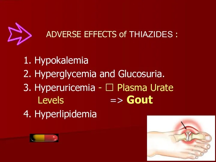 ADVERSE EFFECTS of THIAZIDES : 1. Hypokalemia 2. Hyperglycemia and Glucosuria. 3. Hyperuricemia