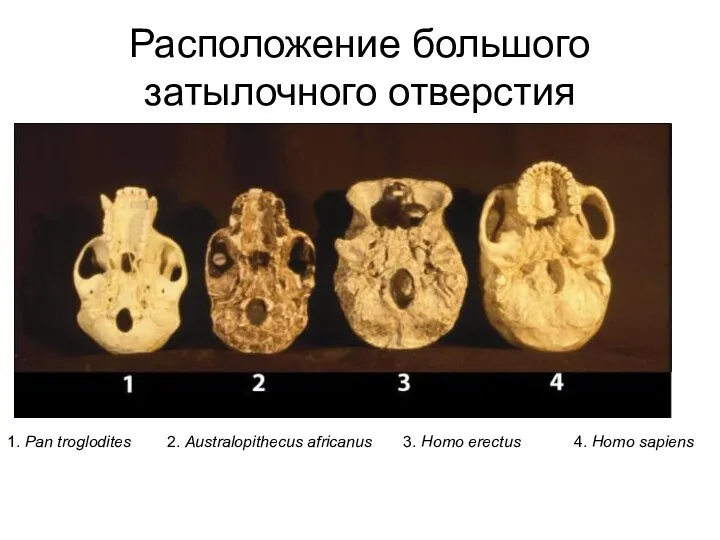 Расположение большого затылочного отверстия 1. Pan troglodites 2. Australopithecus africanus 3. Homo erectus 4. Homo sapiens