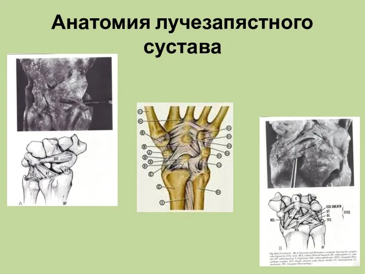 Анатомия лучезапястного сустава