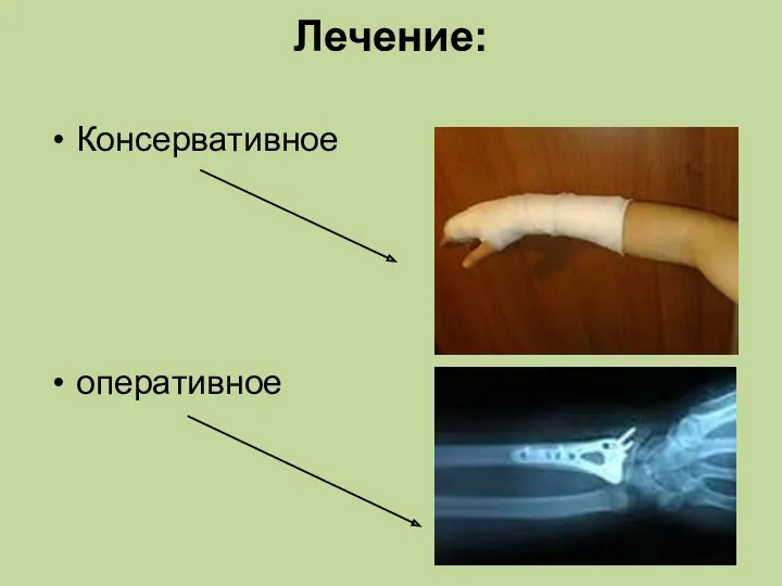 Лечение: Консервативное оперативное