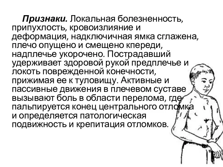 Признаки. Локальная болезненность, припухлость, кровоизлияние и деформация, надключичная ямка сглажена,