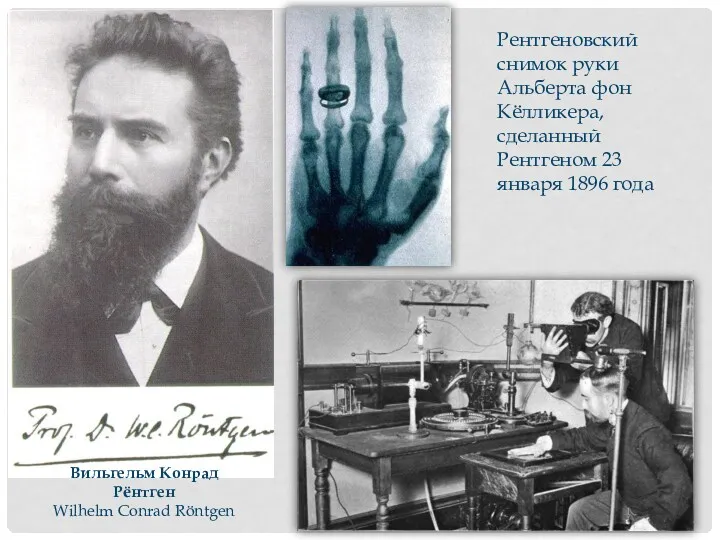 Вильгельм Конрад Рёнтген Wilhelm Conrad Röntgen Рентгеновский снимок руки Альберта