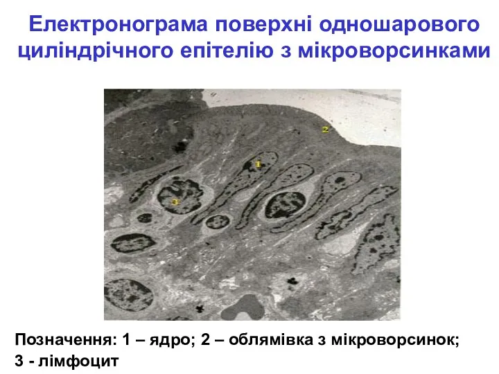 Електронограма поверхні одношарового циліндрічного епітелію з мікроворсинками Позначення: 1 –