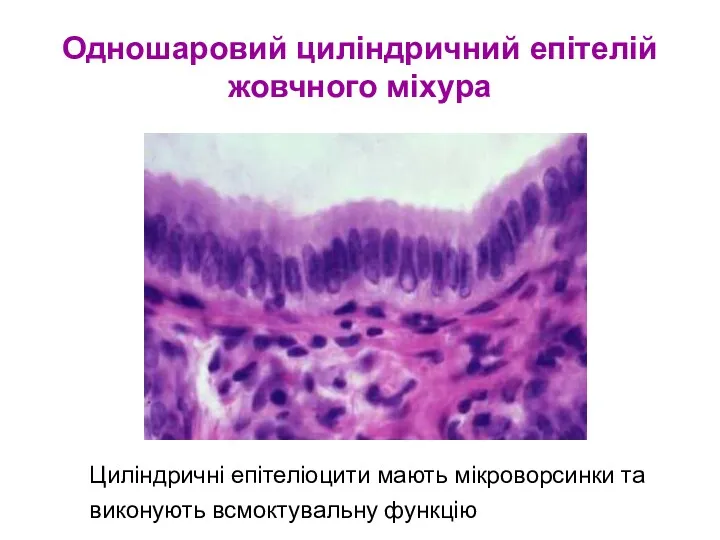 Одношаровий циліндричний епітелій жовчного міхура Циліндричні епітеліоцити мають мікроворсинки та виконують всмоктувальну функцію
