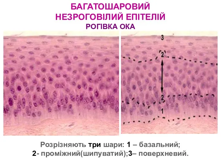 БАГАТОШАРОВИЙ НЕЗРОГОВІЛИЙ ЕПІТЕЛІЙ РОГІВКА ОКА Розрізняють три шари: 1 – базальний; 2- проміжний(шипуватий);3– поверхневий.