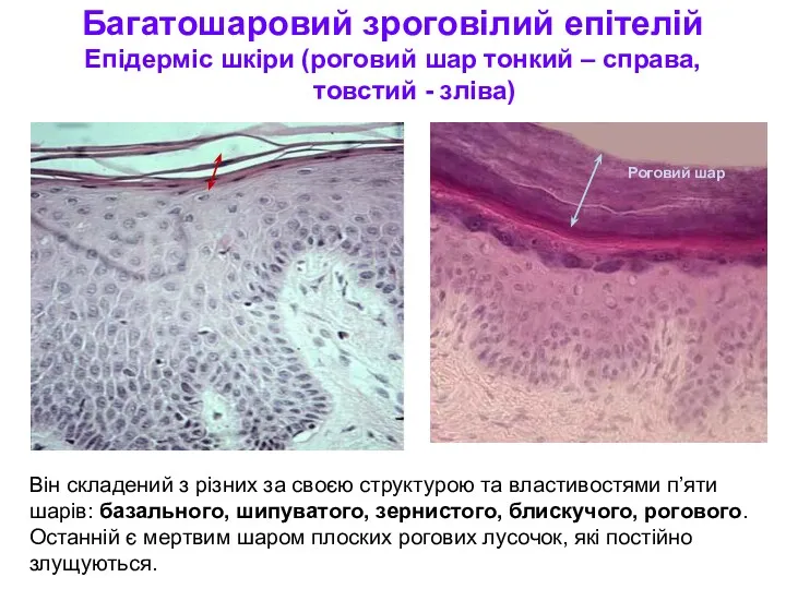 Багатошаровий зроговілий епітелій Епідерміс шкіри (роговий шар тонкий – справа,